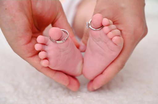 泗洪孕妇怎样预防妊娠纹